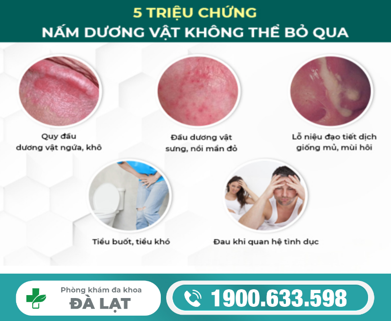 Hình ảnh minh họa